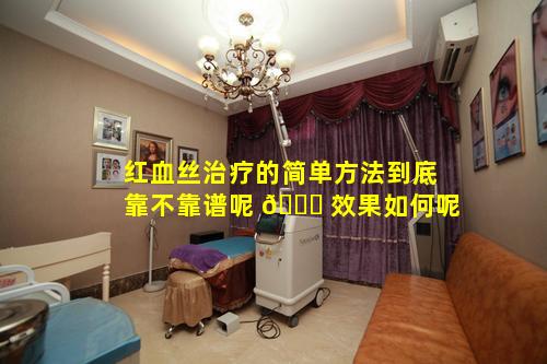红血丝治疗的简单方法到底靠不靠谱呢 🐎 效果如何呢